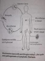 Filariasis