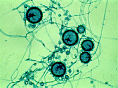 Histoplasma capsulatum