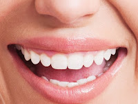 Tips Menghilangkan Bau Mulut