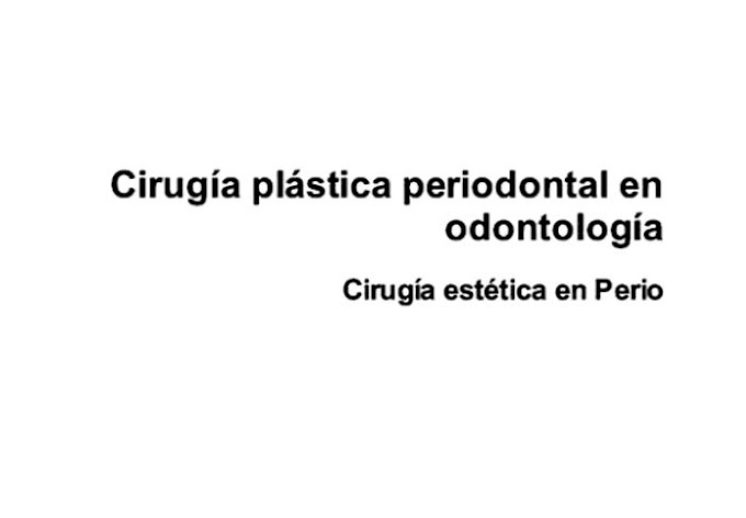 LIBRO: Cirugía plástica periodontal en odontología: Cirugía estética en Perio - Ediciones Nuestro Conocimiento 2022