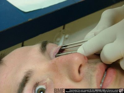 Extreme Piercing - Eye Piercing