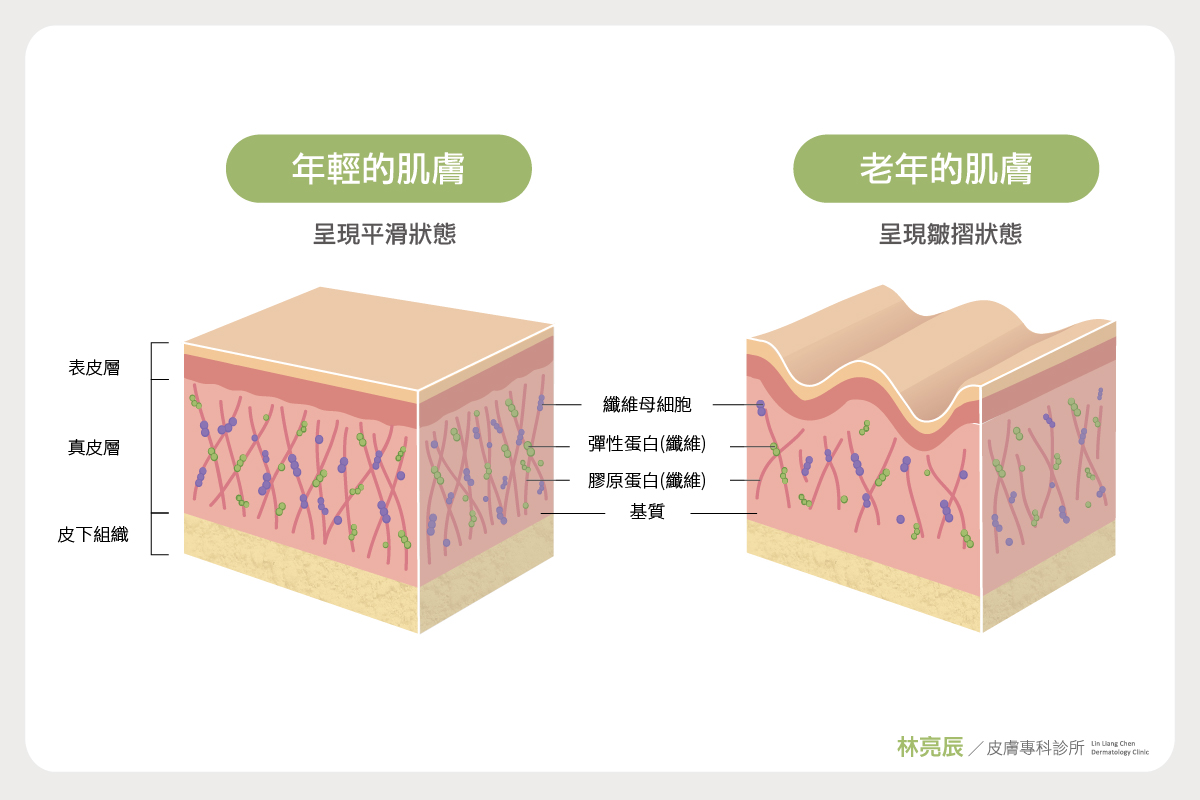 膠原蛋白是由「纖維母細胞」所合成製造，當肌膚老年便會呈現皺摺狀態