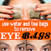 How To Get Rid Of Bags Under Eyes Fast Best Home Remedies