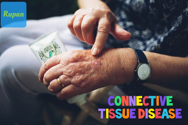 Connective tissue diseas