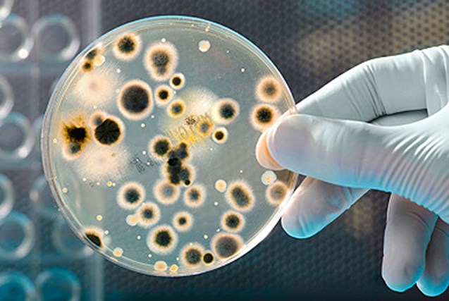 Gambar Ilustrasi Bakteri Pada Cawan Petri