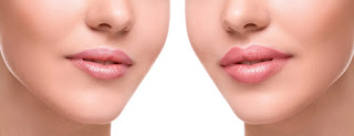 La terapia regeneradora de labios