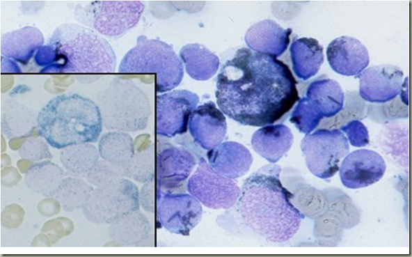 KOLEKSI TUGASAN: DIAGNOSTIK HEMATOLOGI-SITOKIMIA