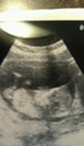 First Ultrasound First Ultrasound