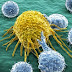 Μάθετε με τι τρέφονται τα καρκινικά κύτταρα ώστε να τα αποφεύγετε!