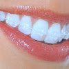 Train Track Braces - Clear Ceramic Braces O Keeffe Orthodontics Invisalign Invisible Braces Clear Braces / Things tagged with 'train_track' (221 things).