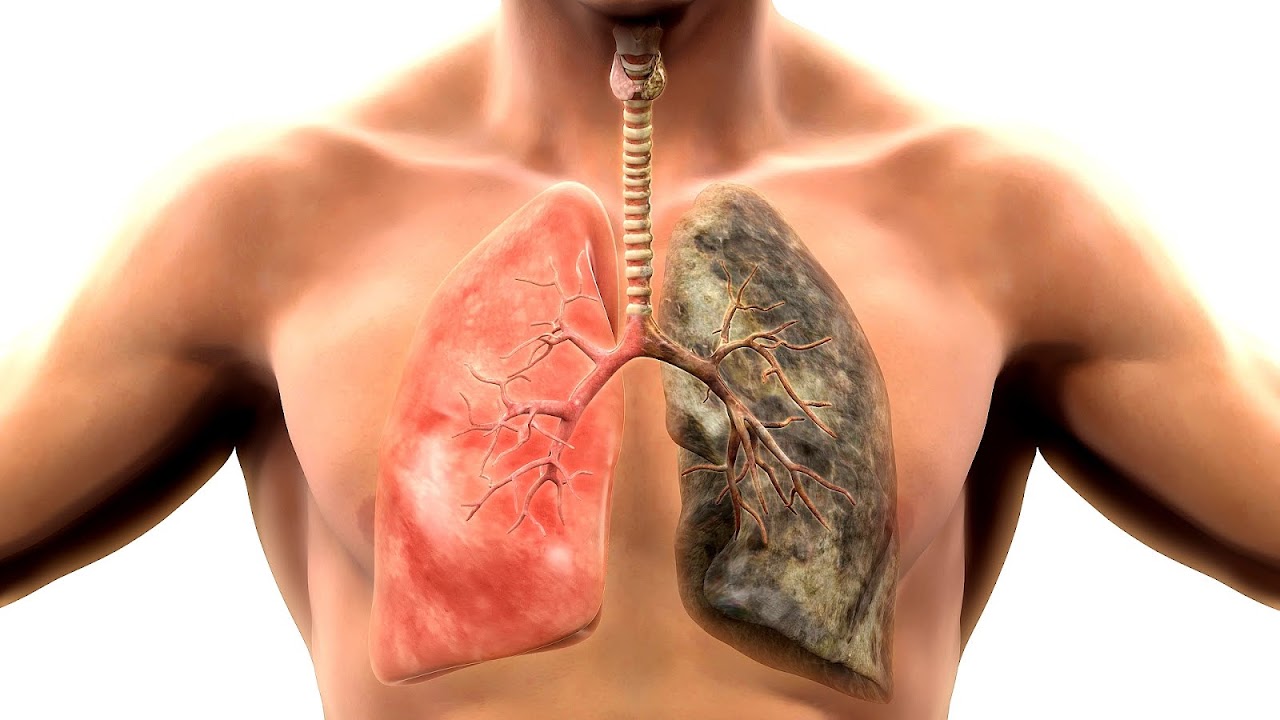 Health effects of tobacco