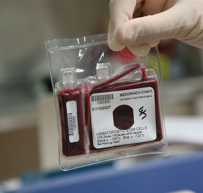 How Long Can Cord Blood Stem Cells be Stored? 