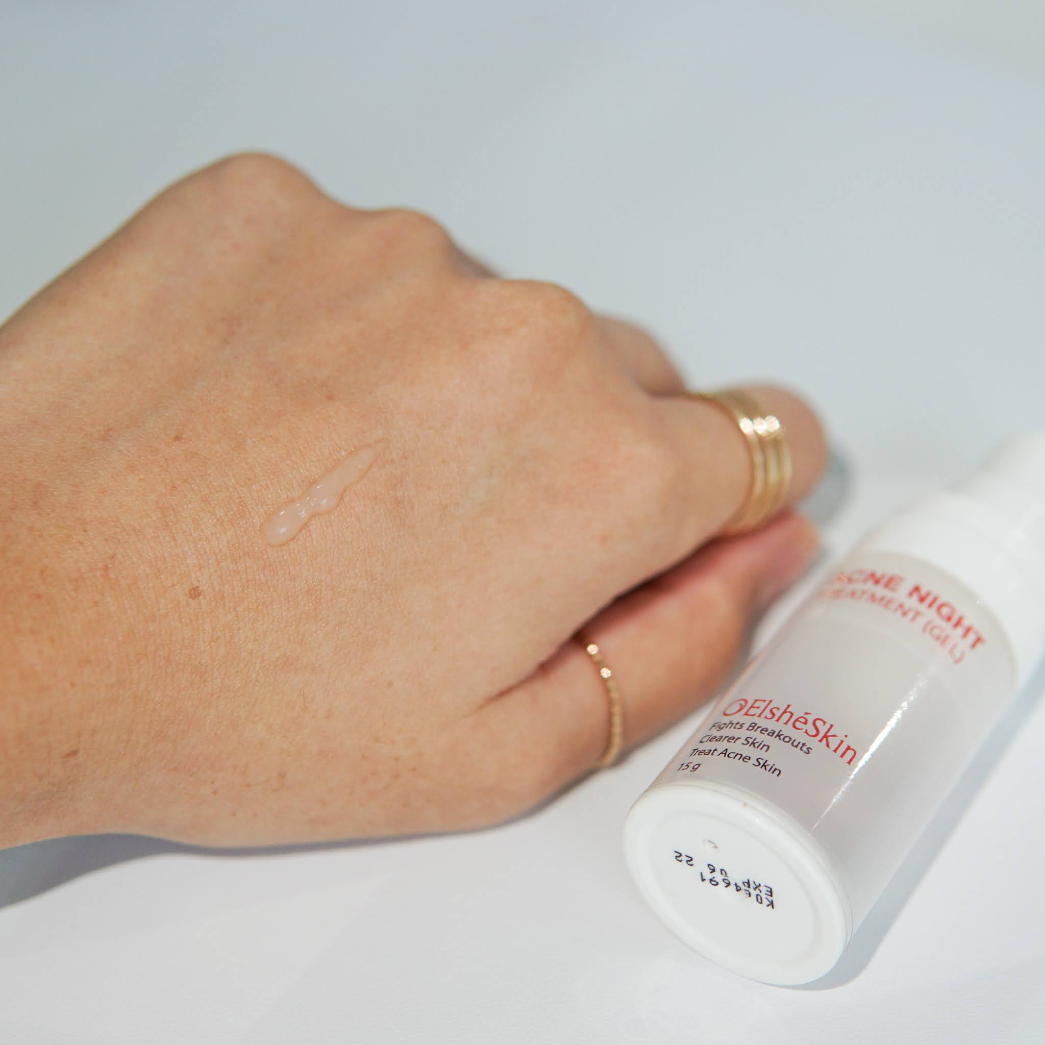 review  obat jerawatspot treatment terbaik favoritku skin game