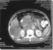 clip_image051_thumb