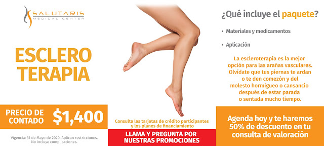 Tratamiento varices laser escleroterapia precio costo Guadalajara Mexico