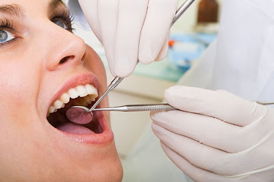 Nhổ 4 răng để niềng răng có ảnh hưởng gì không?