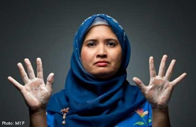 Wanita Ini Cuci Tangan Hingga 300 Kali Dalam Sehari [ www.Bacaan.ME ]