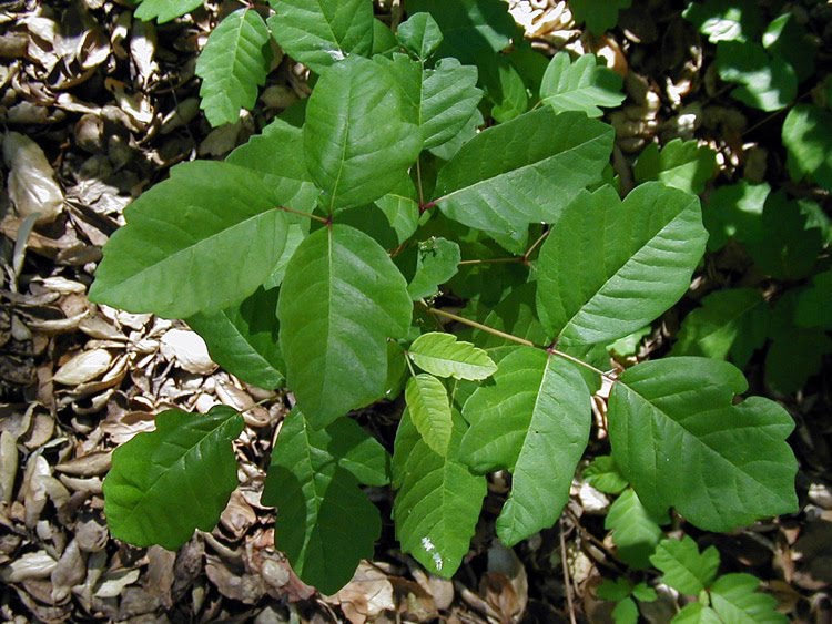 mild poison sumac rash. mild poison sumac rash. with