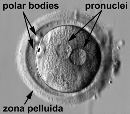 Cigoto humano dicarionte, es decir, con dos núcleos haploides no fusionados.