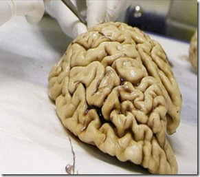 gen cerebro