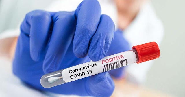 Reportaron 117 nuevos casos positivos de Coronavirus en Jujuy 