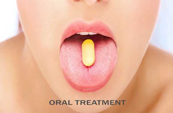 Pengobatan Oral Jerawat karena Hormon