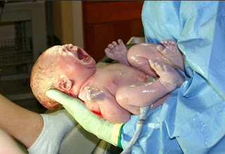 Newborn Care