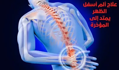 علاج ألم أسفل الظهر يمتد إلى المؤخرة