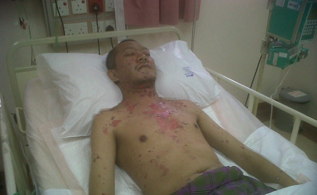 SharpShooter: Blogger Hijat terlantar di ICU Hospital Pantai
