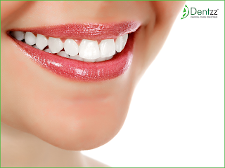 Cosmetic Dentistry_Dentzz Dental Care