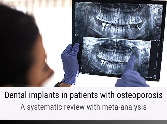 PDF: Dental implants in patients with osteoporosis: a systematic review with meta-analysis