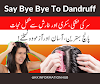 How To Remove Hair Dandruff Quickly & Permanently ?