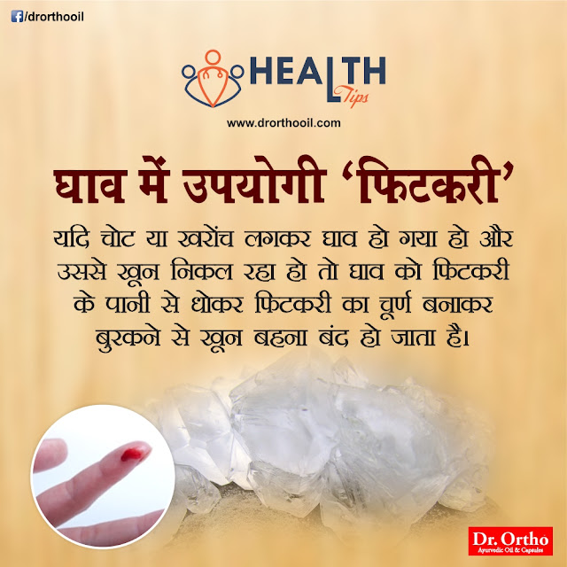 Health Tips for Wounds