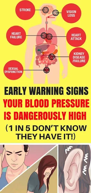 Early Warning Signs Your Blood Pressure Is Dangerously High (1 In 5 Don’t Know They Have It!)