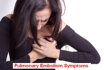 Pulmonary Embolism Causes, Signs-Symptoms And Treatment