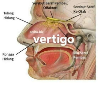 MENGOBATI VERTIGO  CUKUP dgn LUBANG HIDUNG