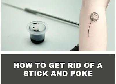 How To Get Rid Of A Stick and Poke