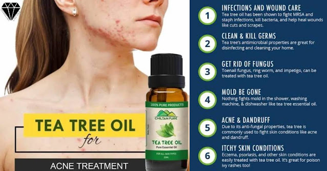 Best Tea Tree Oil Brand for Acne in India