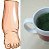  Powerful Natural Remedy For Swollen Legs !