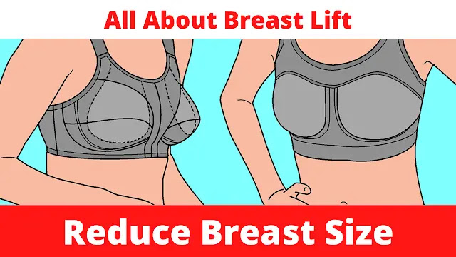Does a breast lift reduce breast size
