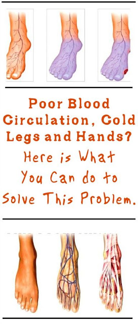 Poor Blood Circulation, Cold Hands And Legs? Here Is What You Can Do To Solve This Problem