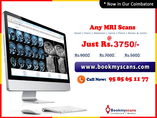 Coimbatore MRI Scans Cost