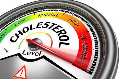 Serangan Jantung Disebabkan Kolesterol Tinggi