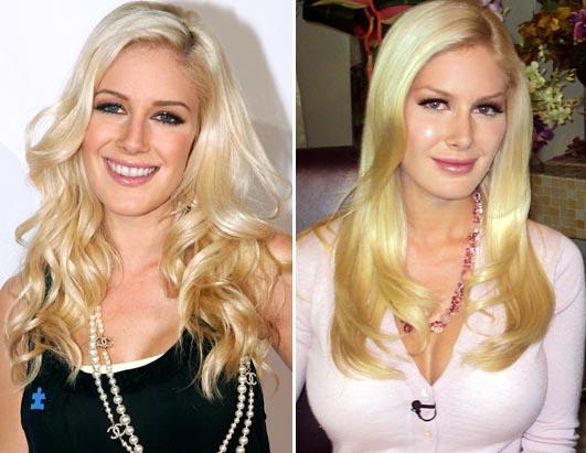 heidi montag plastic surgery regret. Heidi Montag before and after