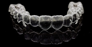 Niềng răng trong suốt có hiệu quả không Niềng răng trong suốt có hiệu quả không-2