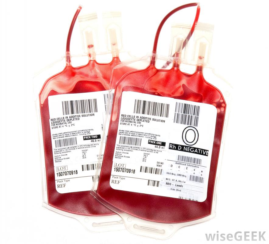 Apa itu transfusi darah dan bagaimana klasifikasi golongan 