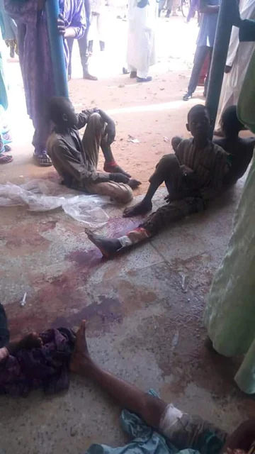 Graphic photos of injured victims after the gunfire attack in Zamfara