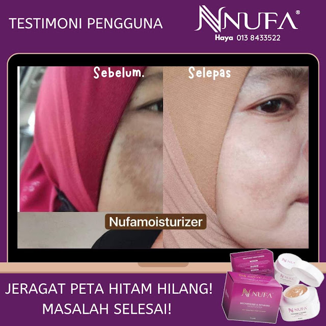 TESTIMONI NUFA TREATMENT MOISTURIZER