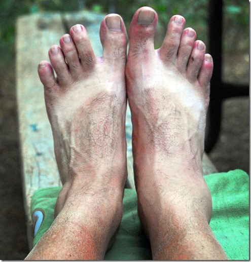 Foot 1