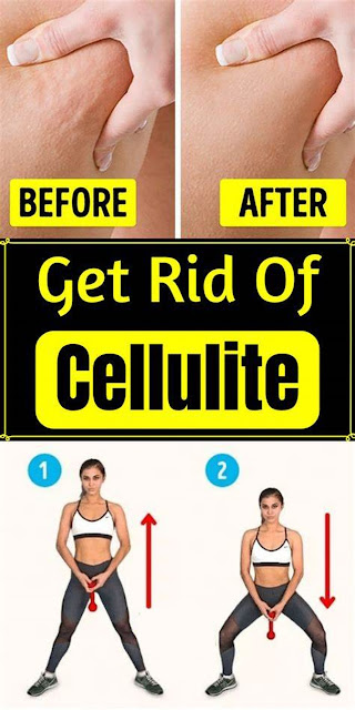 Three Easy Steps to Reduce Cellulite